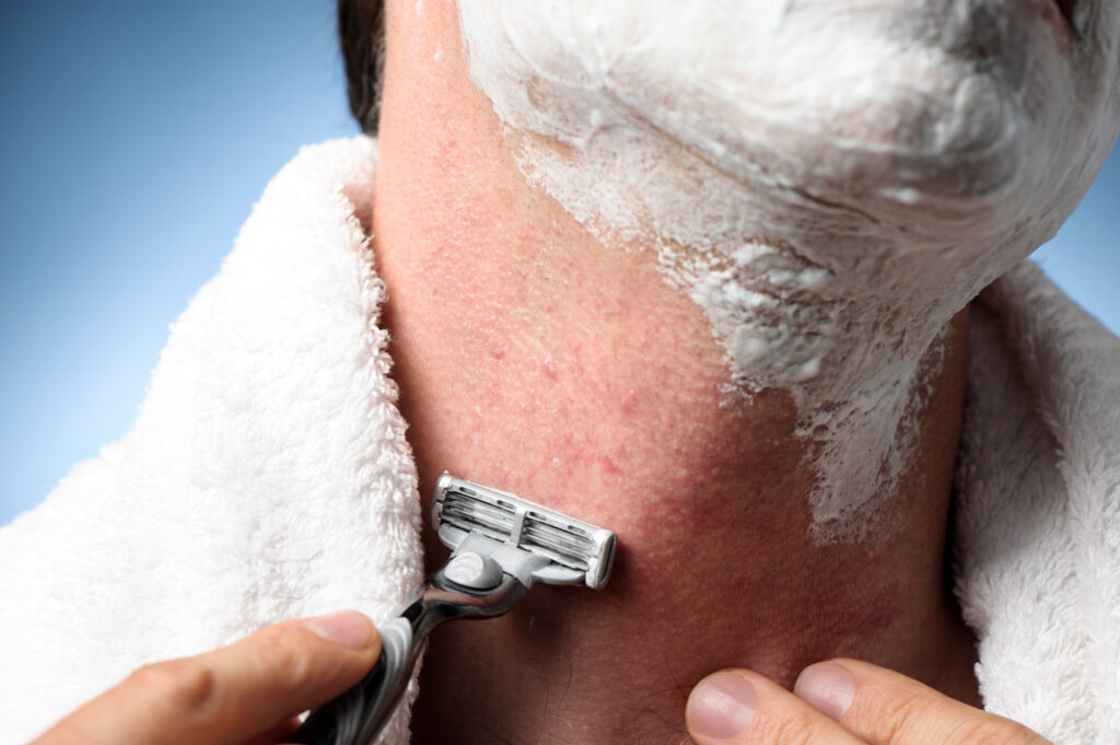 How to Get Rid of Razor Bumps on Your Neck